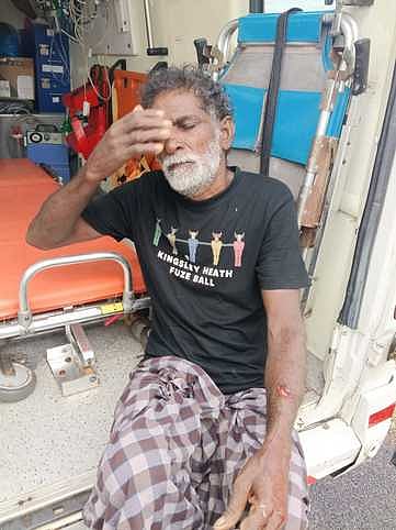 சாயல்குடியில் காட்டுப் பன்றி  தாக்கியதில் விவசாயி காயம்